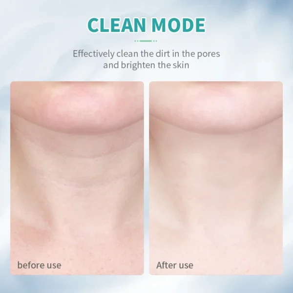 ANLAN EMS Lifting Visage Cou 3 Couleurs