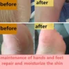 NutriFeet