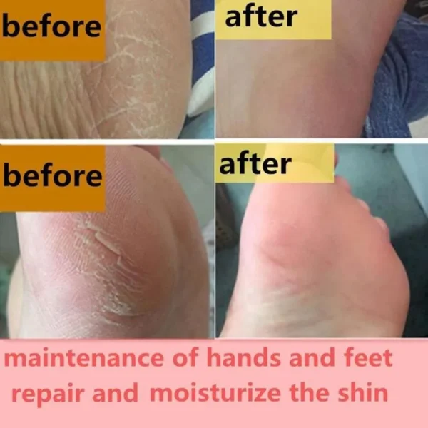 NutriFeet