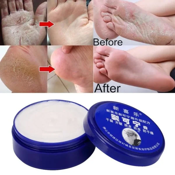 NutriFeet
