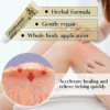 Sumifun: Crème eczéma/urticaire, anti-démangeaisons et inflammation, 20g.