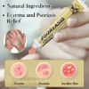 Sumifun: Crème eczéma/urticaire, anti-démangeaisons et inflammation, 20g.