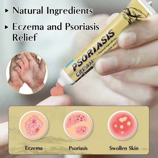 Sumifun: Crème eczéma/urticaire, anti-démangeaisons et inflammation, 20g.