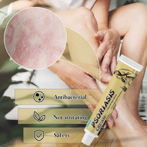 Sumifun: Crème eczéma/urticaire, anti-démangeaisons et inflammation, 20g.