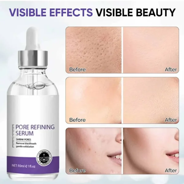 Sérum visage : resserre pores, raffermit, répare, minimise.